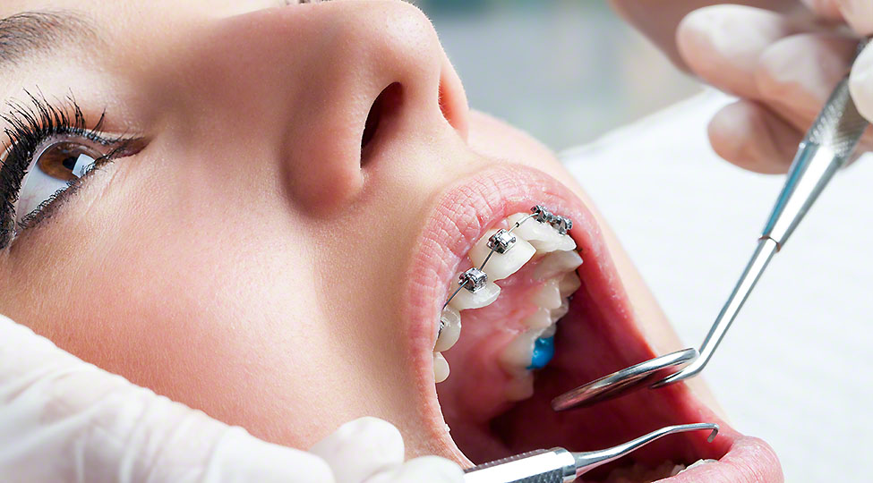 Why You May Need A Tooth Extraction